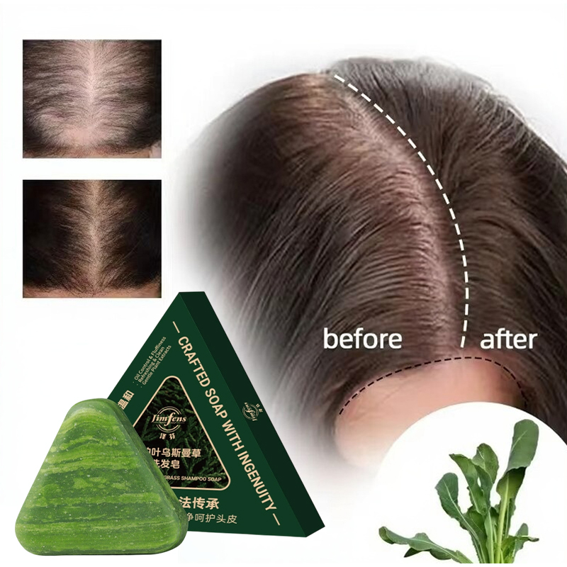Anti-hair Loss Shampoo Bar! Wi - đánh giá và giá Castor Oil Soap